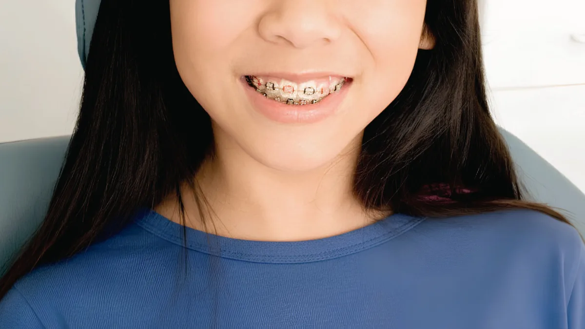 Child Braces