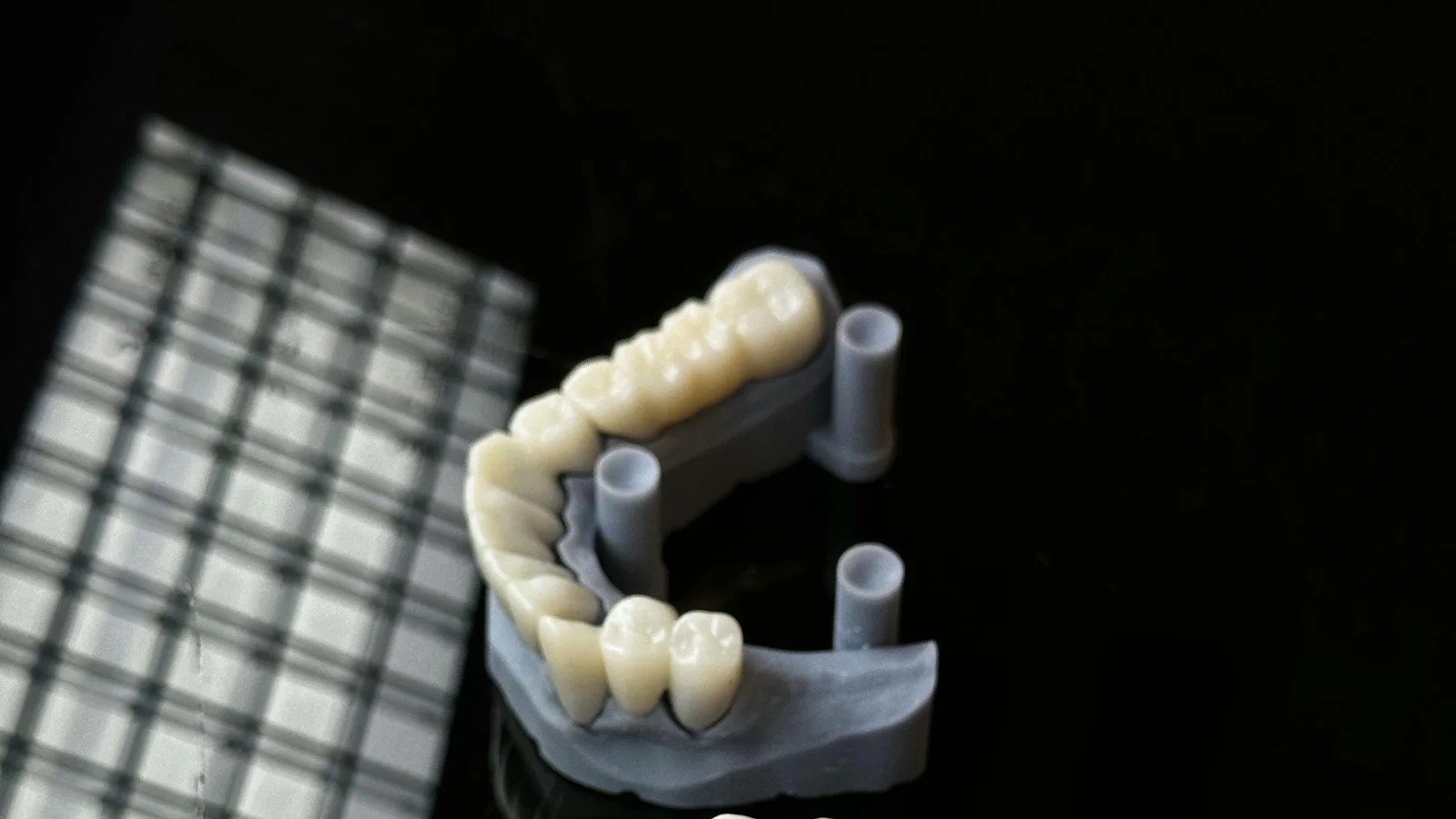 Dental Crowns